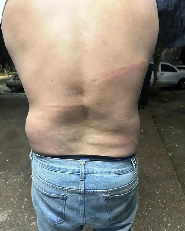 Victima de patovicas